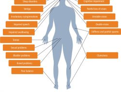 Ms Health Informatics Online Elevating Healthcare Insights